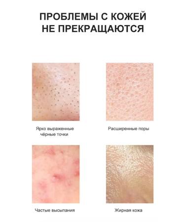 Get rid of acne on the face to lighten the pigmentation of the antiv ... - Buy Online on GoSupps.com