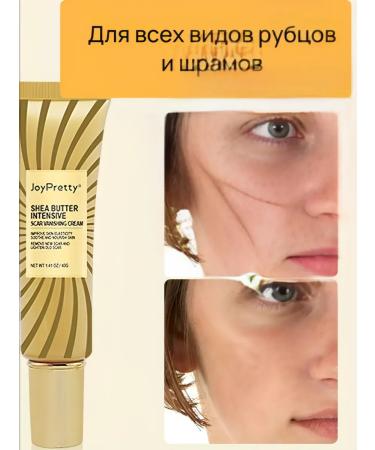 JoyPrettyin Cream from stretch marks and scars - Buy Online on GoSupps.com