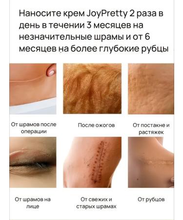 JoyPrettyin Cream from stretch marks and scars - Buy Online on GoSupps.com