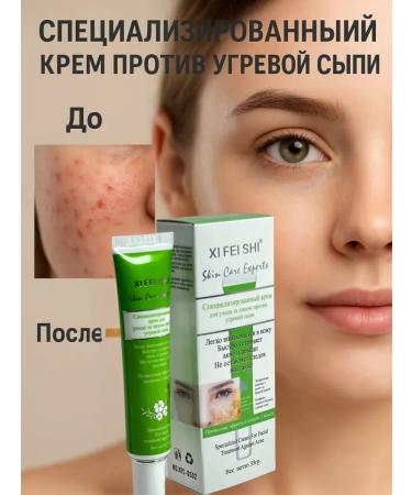 Havvamii Cream from acne on the face and body for a teenager - Buy Online on GoSupps.com