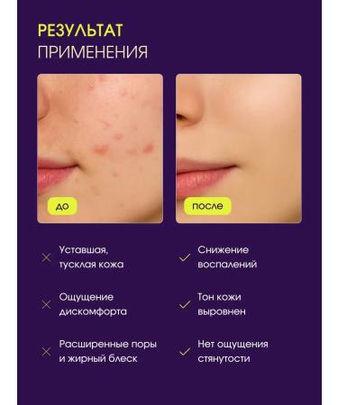 STOP Demodex Mask for cleansing and narrowing pores - Buy Online on GoSupps.com