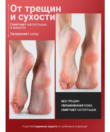 Capital pharm product Ointment from the fungus of nails and legs - Buy Online on GoSupps.com