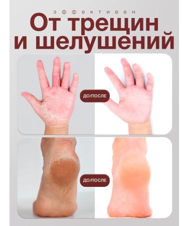 Kerasal Ointment from nail fungus - Buy Online on GoSupps.com