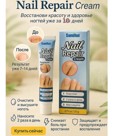 kosmosKS Cream for treating the nail on the legs Strengthening recovery