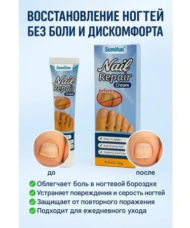 Aurexen To restore nails cream