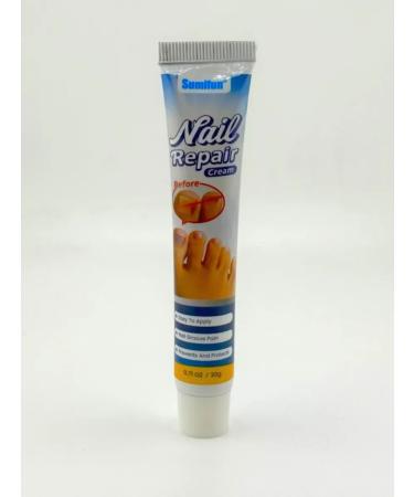Aurexen To restore nails cream - Buy Online on GoSupps.com