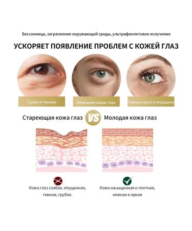 Against wrinkles of the eye cream Moisturizing Anti-Age Care retinol - Buy Online on GoSupps.com