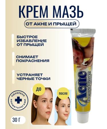 Life1 Cream ointment from acne and acne acne and post -acne effective
