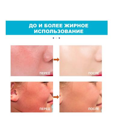 Waterproof and diaphoretic sunscreen Protect2 pcs - Buy Online on GoSupps.com