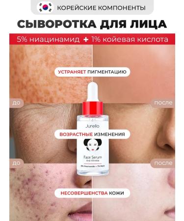 Jurello Facial serum with niacinamide