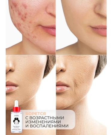 Jurello Facial serum with niacinamide - Buy Online on GoSupps.com