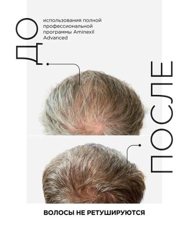 L'OREAL Hair ampoules Serie Expert Aminexil Advanced 42*6 ml - Buy Online on GoSupps.com