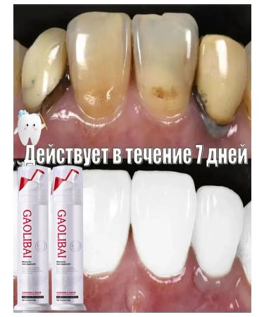 Toothpaste whitening with a probiotic 120g