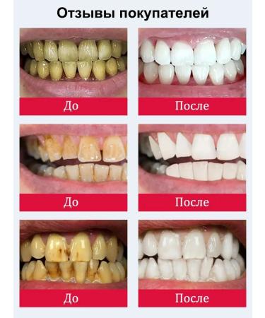 Toothpaste whitening with a probiotic 120g - Buy Online on GoSupps.com