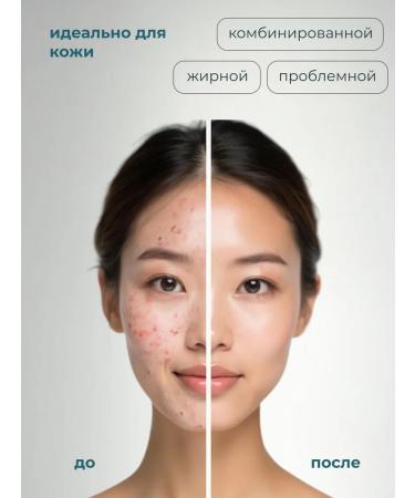 BELITA Cleaning micro-peeling for the face from black dots and acne - Buy Online on GoSupps.com