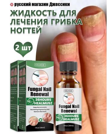 Eelhoe treatment of onychomycosis of nail fungus nail repair 60ml