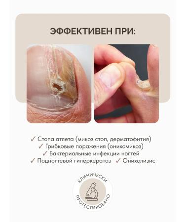 Famous Names ACESO Two -phase set for nail treatment + Debrider - Buy Online on GoSupps.com