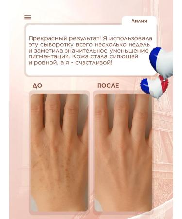 SOPHIE BONTE LV Cream whitening for the face and body set - Buy Online on GoSupps.com