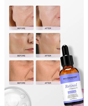 NEUTRIHERBS Facial serum with retinol and vitamin E - Buy Online on GoSupps.com