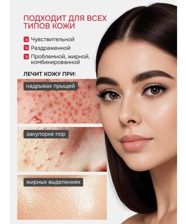 KORUMEISUI Cream gel from acne and acne on the face and body - Buy Online on GoSupps.com