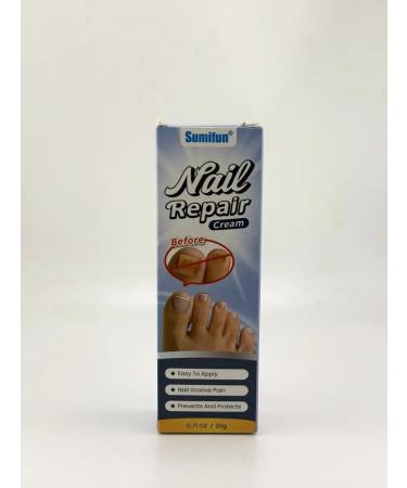 AKMarket Cream from an ingrown nail to relieve pain and recovery - Buy Online on GoSupps.com