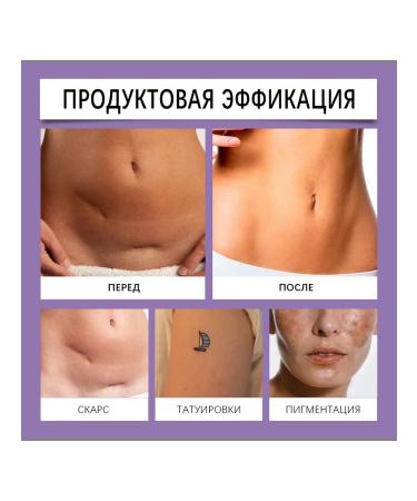 Eelhoe Conceler and a restorative body cream - Buy Online on GoSupps.com