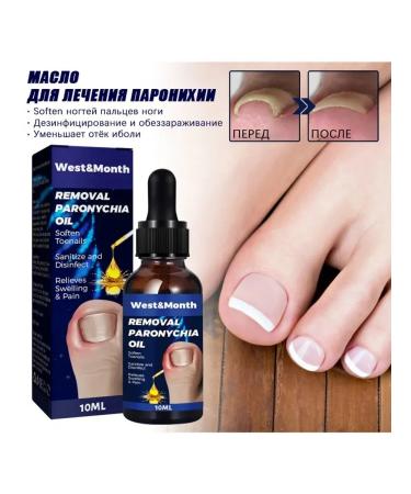 nail treatment of legs restoring essential oil