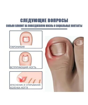 nail treatment of legs restoring essential oil - Buy Online on GoSupps.com