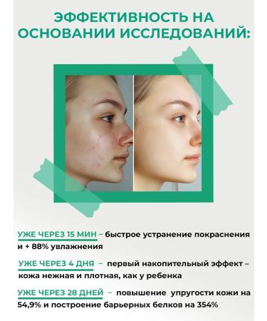 BioHyalux Nourishing fabric face masks against acne 5 pcs. x 30 g. - Buy Online on GoSupps.com