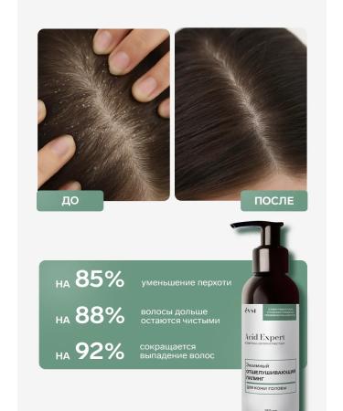 EVSI Exfoliating enzyme peeling for scalp - Buy Online on GoSupps.com