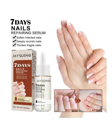 JaySuing nail care for 7 days