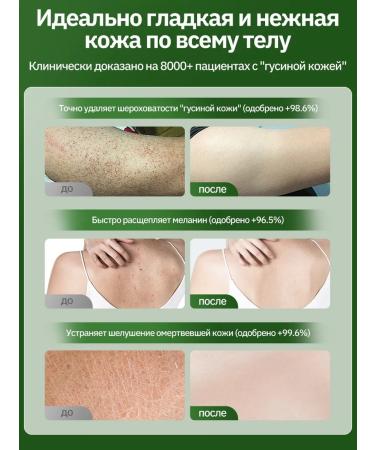 Delicate body scrub 250 g - eliminates chicken skin - Buy Online on GoSupps.com
