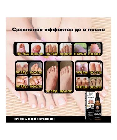 eelhoe thickening nails Care restoring cracks solution 30 ml - Buy Online on GoSupps.com