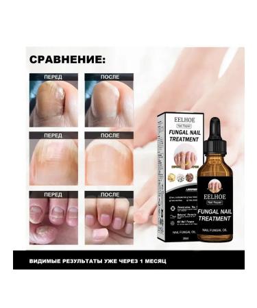 eelhoe thickening nails Care restoring cracks solution 30 ml - Buy Online on GoSupps.com