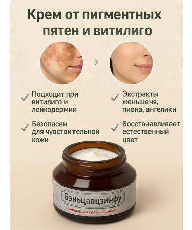 Aurexen Cream from age spots on the face from Vitiligo