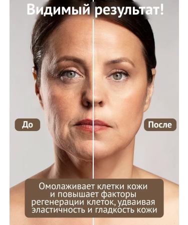 Eshumi Facial serum anti -aging 35ml Korea - Buy Online on GoSupps.com