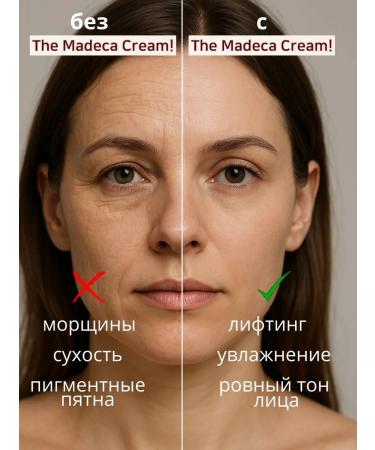 Eshumi Moisturizer face cream Madeca with Korea Centella 50 ml - Buy Online on GoSupps.com