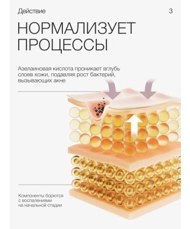 To my scin Azelain peeling 30ml - Buy Online on GoSupps.com