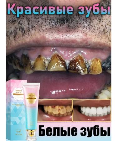 Super bleaching toothpaste teeth whitening agent