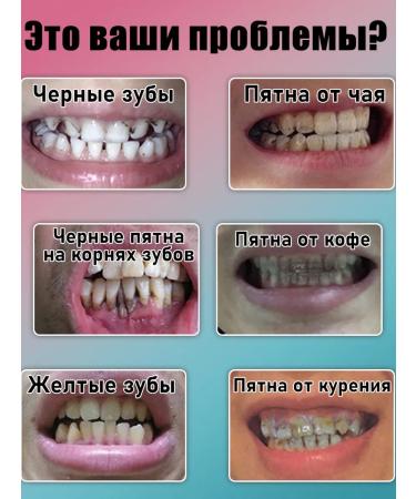 Super bleaching toothpaste teeth whitening agent - Buy Online on GoSupps.com