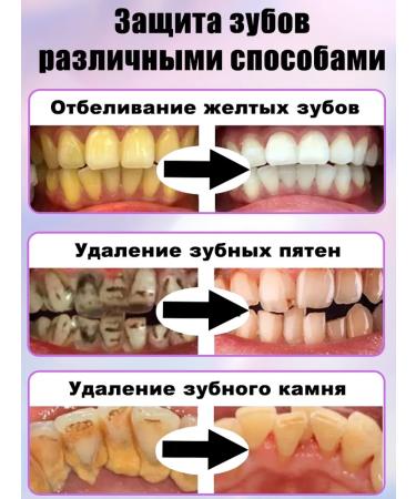 Super bleaching toothpaste teeth whitening agent - Buy Online on GoSupps.com
