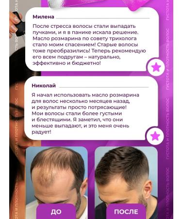 LUCAS PREMIUM LC Hair growth with rosemary activator - Buy Online on GoSupps.com