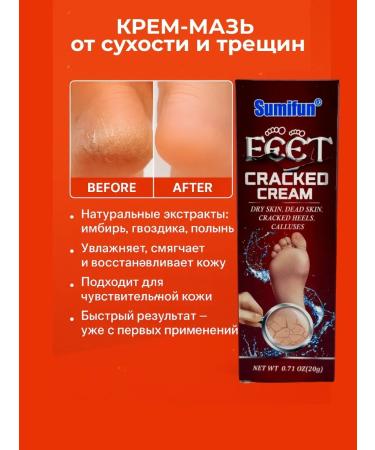 Life Healing ointment from cracks on the heels cream from dry legs