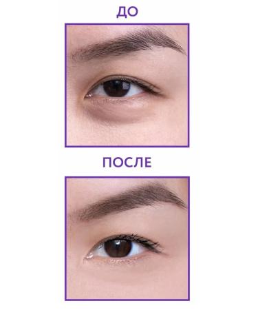 ARAVIA Hyaluron Eye Patch eyes for eyes 30 ml - Buy Online on GoSupps.com