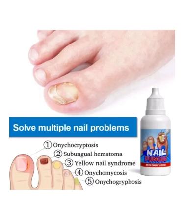 Nail fungus remedy - Buy Online on GoSupps.com