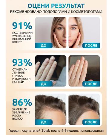 SOLAB CO2 Monarchy Oil Extract for cuticle and nails - Buy Online on GoSupps.com