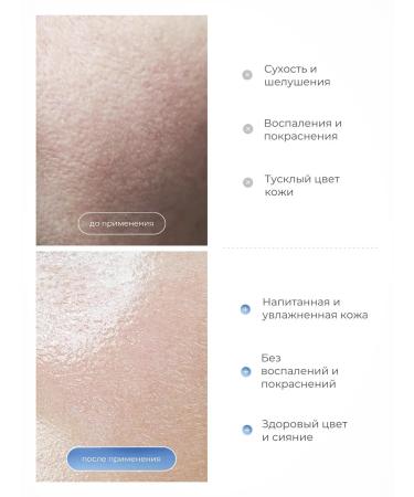 Yar'Co Cream for face and body moisturizer 170 grams - Buy Online on GoSupps.com