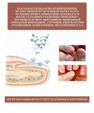 Paronichia oil for nail care - Buy Online on GoSupps.com