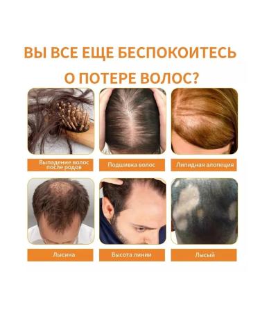 eelhoe Hair growth Essential oil preventing the aging of wrinkles 60ml - Buy Online on GoSupps.com