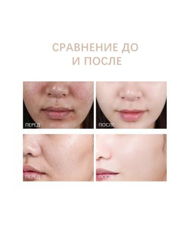 OUHOE Exfoliating Gel - Buy Online on GoSupps.com